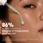 peau-serum-anti-imperfections-pure-1